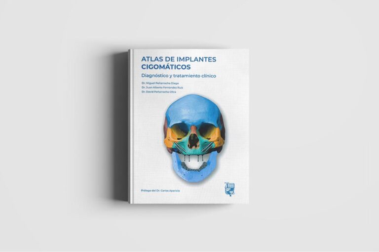 LIBRO_Atlas implantes cigomáticos