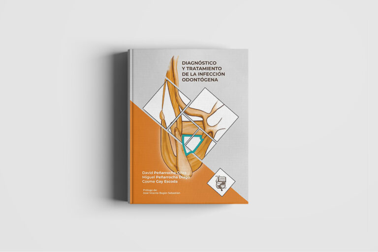LIBRO_diagnostico-y-tratamiento-de-la-infeccion-odontogenica