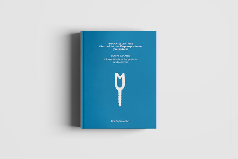 Libro implantes dentales